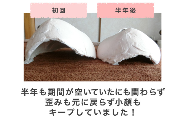 1回の施術でも顔の変化がわかる