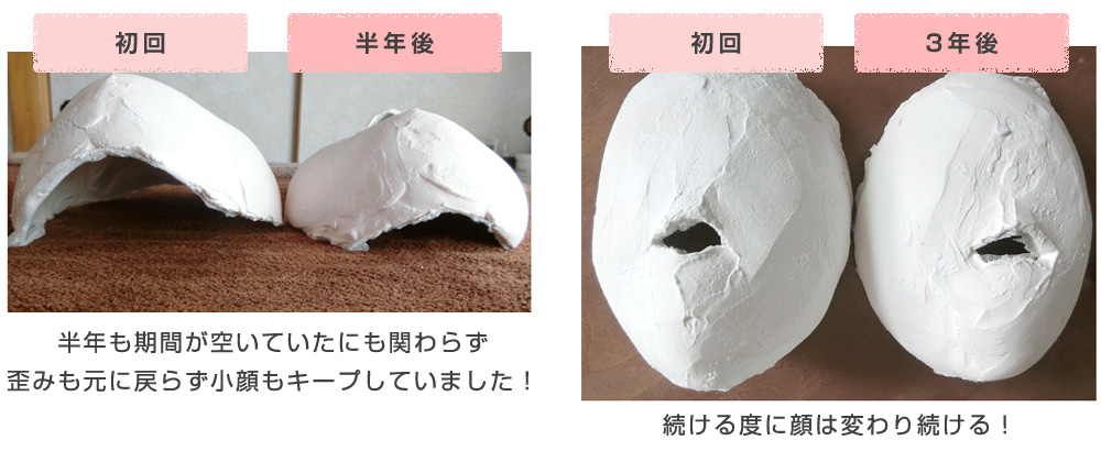 1回の施術でも顔の変化がわかる