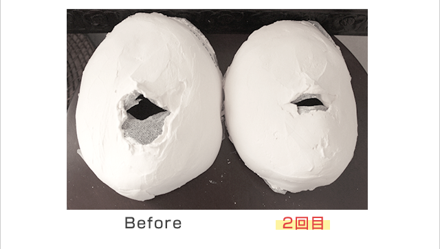 顔が小さくなり、鼻も少し高くなりました。