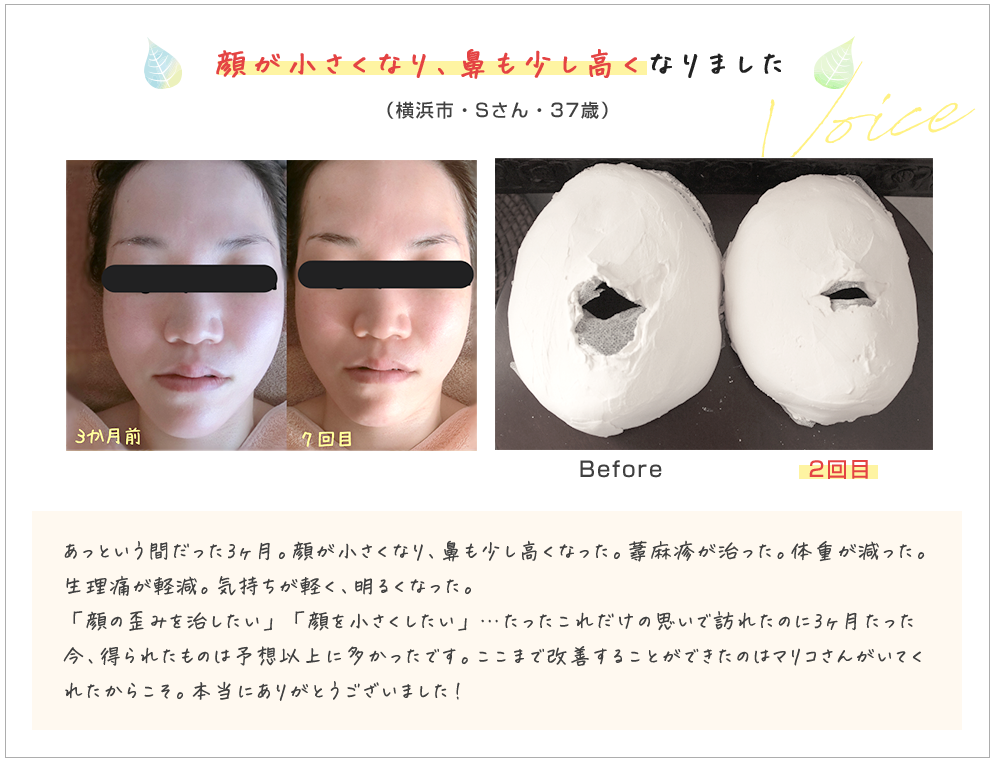 顔が小さくなり、鼻も少し高くなりました。